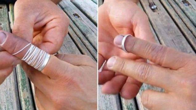 Enlever Une Bague Coinc E Au Doigt Guide Astuces