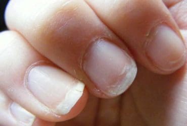 Ce que vos ongles révèlent sur votre santé