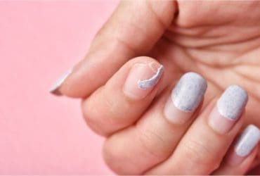 Ongles cassants : causes et traitements